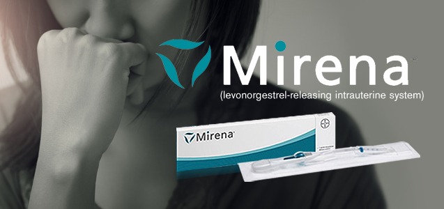 Mirena IUD