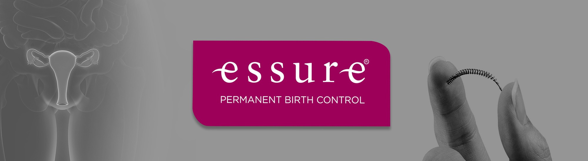 Essure Injury Attorneys Essure Birth Control Side Effects Lawyers