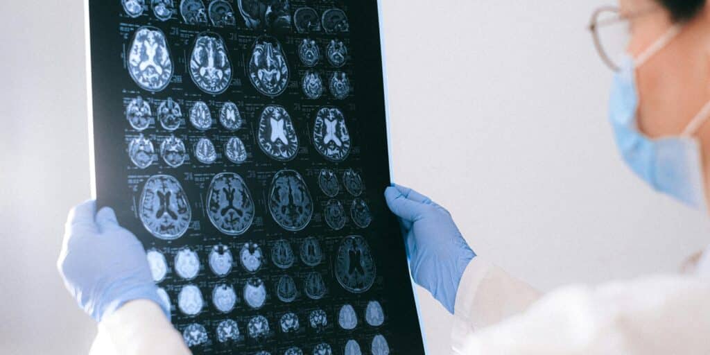 Best Brain Injury Lawyer Maryland
